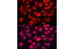 Immunofluorescence analysis of C6 cells using C Rabbit pAb (ABIN7266110) at dilution of 1:50 (40x lens). (Caspase 1 antibody)