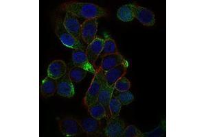 Immunofluorescence analysis of MCF-7 cells using CD59 mouse mAb (green).