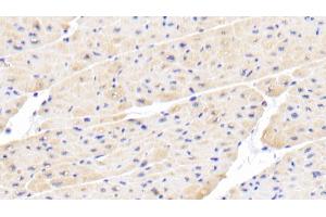 Detection of IL18 in Porcine Cardiac Muscle Tissue using Polyclonal Antibody to Interleukin 18 (IL18) (IL-18 antibody  (AA 36-192))