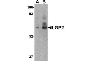 Western Blotting (WB) image for anti-DEXH (Asp-Glu-X-His) Box Polypeptide 58 (DHX58) (C-Term) antibody (ABIN1030481) (DHX58 antibody  (C-Term))