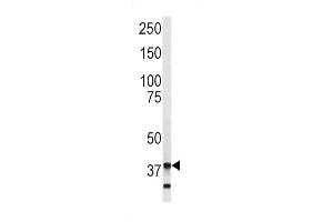 Western blot analysis of Annexin V antibody (C-term) (ABIN390502 and ABIN2840858) in SK-Br-3 cell line lysates (35 μg/lane). (Annexin V antibody  (C-Term))