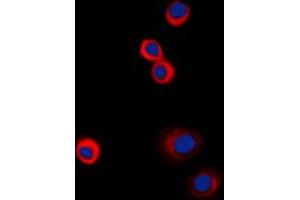 Immunofluorescent analysis of IGF1 Receptor (pY1161) staining in HeLa cells. (IGF1R antibody  (C-Term, pTyr1161))