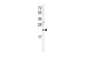 HRAS antibody  (AA 104-128)