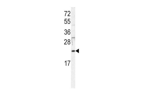 HRAS antibody  (AA 104-128)