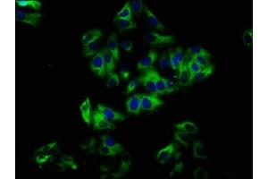 Immunofluorescence staining of HepG2 cells with ABIN7161004 at 1:33, counter-stained with DAPI. (NOX1 antibody  (AA 418-564))