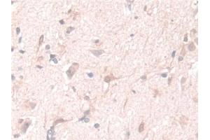 Detection of PGM1 in Human Cerebrum Tissue using Polyclonal Antibody to Phosphoglucomutase 1 (PGM1) (Phosphoglucomutase 1 antibody  (AA 1-235))