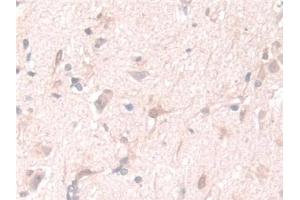 Detection of PGM1 in Human Cerebrum Tissue using Polyclonal Antibody to Phosphoglucomutase 1 (PGM1)