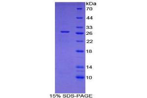 SDS-PAGE (SDS) image for WNT1 Inducible Signaling Pathway Protein 2 (WISP2) (AA 15-250) protein (His tag,GST tag) (ABIN2122340)