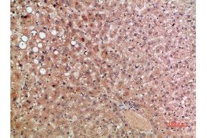 Immunohistochemical analysis of paraffin-embedded human-liver, antibody was diluted at 1:200 (CCR5 antibody  (AA 151-200))