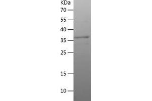 BEX2 Protein (AA 1-128) (His-IF2DI Tag)