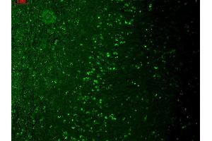 Immunohistochemistry analysis using Mouse Anti-TrpM7 Monoclonal Antibody, Clone S74-25 . (TRPM7 antibody  (AA 1817-1863) (APC))