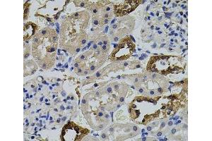 Immunohistochemistry of paraffin-embedded Rat kidney using AURKC Polyclonal Antibody (Aurora Kinase C antibody)