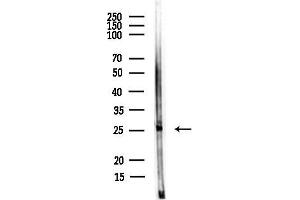 Western blot analysis of lysates from Rat lung, using BarX1 Antibody at 1/1000 dilution.
