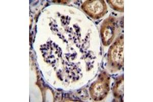 Immunohistochemistry analysis in formalin fixed and paraffin embedded human kidney tissue reacted with Integrin alpha-8 / ITGA8 Antibody (C-term) followed which was peroxidase conjugated to the secondary antibody and DAB staining. (ITGA8 antibody  (C-Term))
