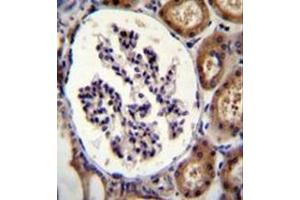 Immunohistochemistry analysis in formalin fixed and paraffin embedded human kidney tissue reacted with Integrin alpha-8 / ITGA8 Antibody (C-term) followed which was peroxidase conjugated to the secondary antibody and DAB staining.