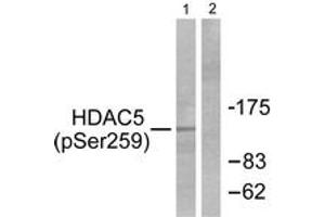 Western blot analysis of extracts from HepG2 cells, using HDAC5 (Phospho-Ser259) Antibody. (HDAC5 antibody  (pSer259))