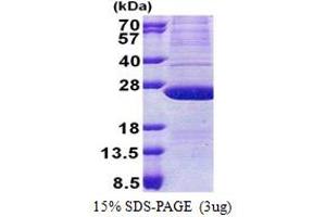 ATP5H Protein (AA 1-161) (His tag)