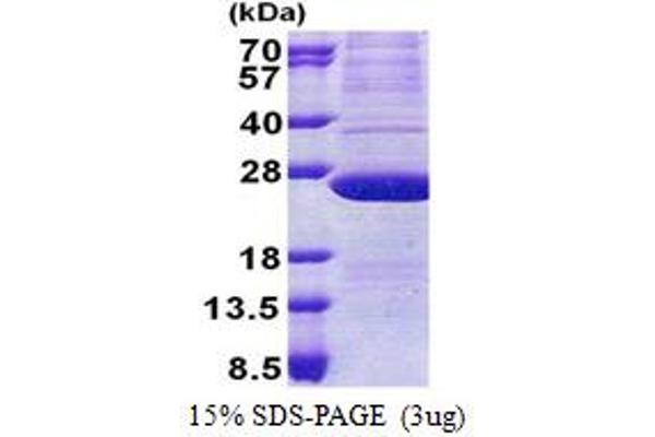 ATP5H Protein (AA 1-161) (His tag)
