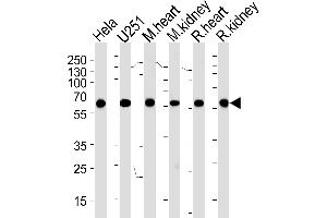 Western blot analysis of lysates from Hela,  cell line, mouse heart and kidney, rat heart and kidney tissue (from left to right), using PHB Antibody (ABIN1882046 and ABIN2838486).