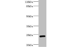Western blot All lanes: STXBP6 antibody at 2 μg/mL + Mouse brain tissue Secondary Goat polyclonal to rabbit at 1/10000 dilution Predicted band size: 24, 12 kDa Observed band size: 24 kDa (STXBP6 antibody  (AA 2-210))