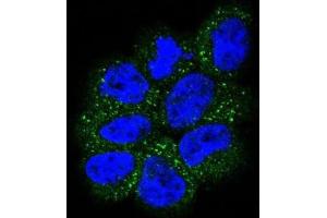 Immunofluorescence (IF) image for anti-GTPase NRas (NRAS) antibody (ABIN3003467) (GTPase NRas antibody)