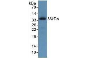 Detection of Recombinant ROS1, Human using Monoclonal Antibody to C-Ros Oncogene 1, Receptor Tyrosine Kinase (ROS1) (ROS1 antibody  (AA 1945-2222))