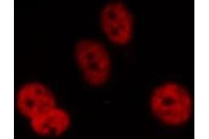 ABIN6277660 staining HepG2 by IF/ICC. (DCLRE1C antibody  (C-Term))