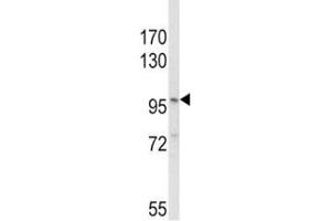 Western blot analysis of NLRP3 antibody and MDA-MB231 lysate (NLRP3 antibody  (AA 65-91))