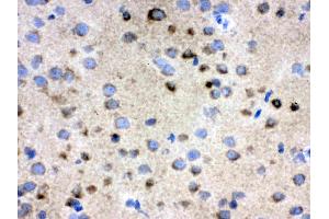 IHC analysis of TCP1 delta using anti-TCP1 delta antibody . (CCT4 antibody  (AA 452-539))