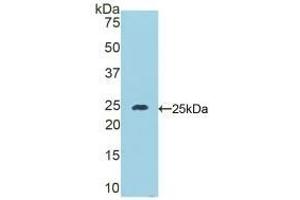Detection of Recombinant DSC1, Mouse using Polyclonal Antibody to Desmocollin 1 (DSC1) (Desmocollin 1 antibody  (AA 135-340))