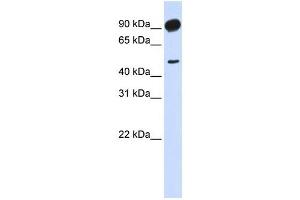 Adducin beta 2 antibody used at 1 ug/ml to detect target protein.