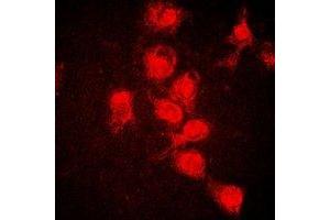 Immunofluorescent analysis of STAT1 (pY701) staining in HeLa cells.
