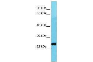 Host: Rabbit Target Name: MRPS26 Sample Type: Jurkat Whole Cell lysates Antibody Dilution: 1.