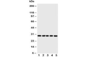 Western blot testing of 14-3-3 sigma antibody and Lane 1:  HeLa;  2: A549;  3: A549;  4: COLO320;  5: SE620 cell lysate (14-3-3 sigma/SFN antibody  (AA 140-156))