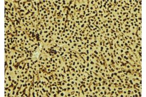 ABIN6277543 at 1/100 staining Mouse liver tissue by IHC-P. (SDCBP antibody  (Internal Region))