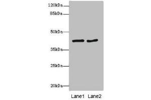 MTCH1 Antikörper  (AA 100-250)