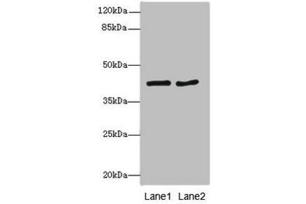 MTCH1 antibody  (AA 100-250)