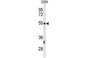 Western blot analysis of CENPI Antibody (Center) in CEM cell line lysates (35µg/lane). (CENPI antibody  (Middle Region))