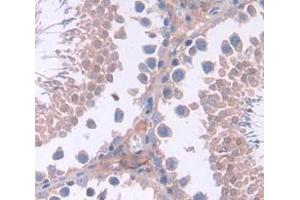 IHC-P analysis of Mouse Tissue, with DAB staining. (SHBG antibody  (AA 219-358))