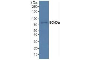 Detection of PDCD6IP in Human Hela Cells using Polyclonal Antibody to Programmed Cell Death Protein 6 Interacting Protein (PDCD6IP) (ALIX antibody  (AA 174-383))