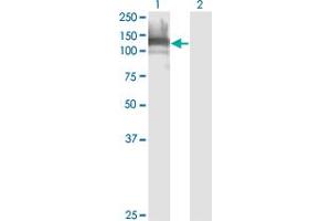 Western Blotting (WB) image for anti-Dishevelled Associated Activator of Morphogenesis 1 (DAAM1) (AA 1-110) antibody (ABIN524909)
