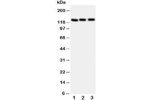 Western blot testing of Myosin Phosphatase antibody and Lane 1:  rat liver;  2: human 293T;  3: (h) HeLa cell lysate. (Myosin Binding Subunit antibody  (N-Term))
