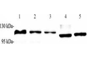 Western blot analysis of ZSCAN20 (ABIN7076252) at dilution of 1: 1000,Lane 1: Raji cell lysate,Lane 2: K562 cell lysate,Lane 3: HEK293 cell lysate,Lane 4: Mouse heart tissue lysate,Lane 5: Rat heart tissue lysate (ZSCAN20 antibody)