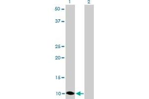 Western Blot analysis of S100A6 expression in transfected 293T cell line by S100A6 monoclonal antibody (M16), clone 6D1. (S100A6 antibody  (AA 18-90))