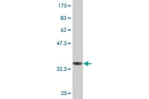 Western Blot detection against Immunogen (35. (HMGCS2 antibody  (AA 424-508))