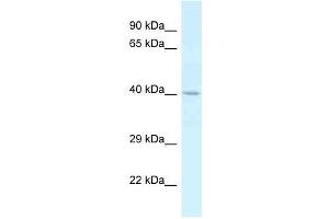 Western Blot showing CTSE antibody used at a concentration of 1. (Cathepsin E antibody  (C-Term))