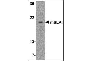 Western blot analysis of SLPI in A-20 cell lysate with this product at 2 μg/ml. (SLPI antibody  (Center))