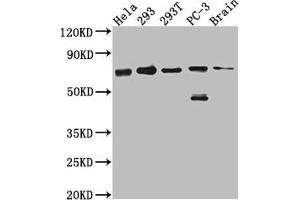 Western Blot Positive WB detected in: Hela whole cell lysate, 293 whole cell lysate, 293T whole cell lysate, PC-3 whole cell lysate, Mouse Brain whole cell lysate All lanes: LTA4H antibody at 1:1000 Secondary Goat polyclonal to rabbit IgG at 1/50000 dilution Predicted band size: 70, 60, 58, 67 kDa Observed band size: 70 kDa (Recombinant LTA4H antibody)