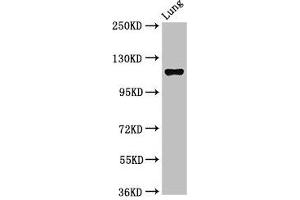 Western Blot Positive WB detected in: Rat lung tissue All lanes: MAP3K9 antibody at 2. (MAP3K9 antibody  (AA 864-1098))