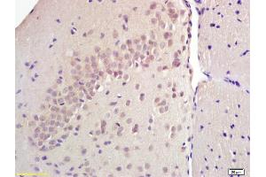 Formalin-fixed and paraffin embedded rat brain labeled with Anti SREBP-1 Polyclonal Antibody, Unconjugated (ABIN686032) at 1:200 followed by conjugation to the secondary antibody and DAB staining (Srebp-1/2 (AA 301-450) antibody)
